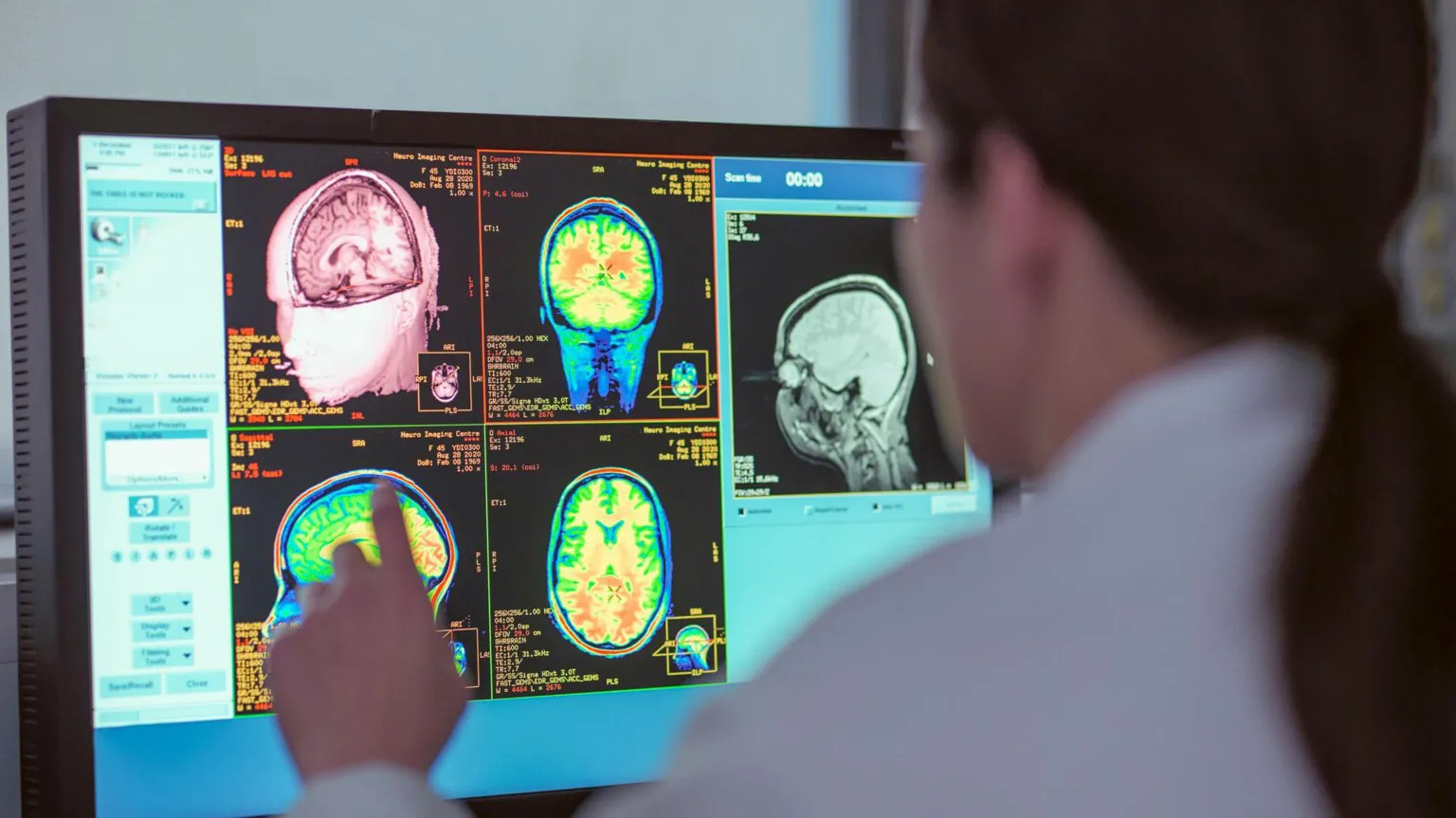 Study reveals five distinct phases of brain development across lifespan