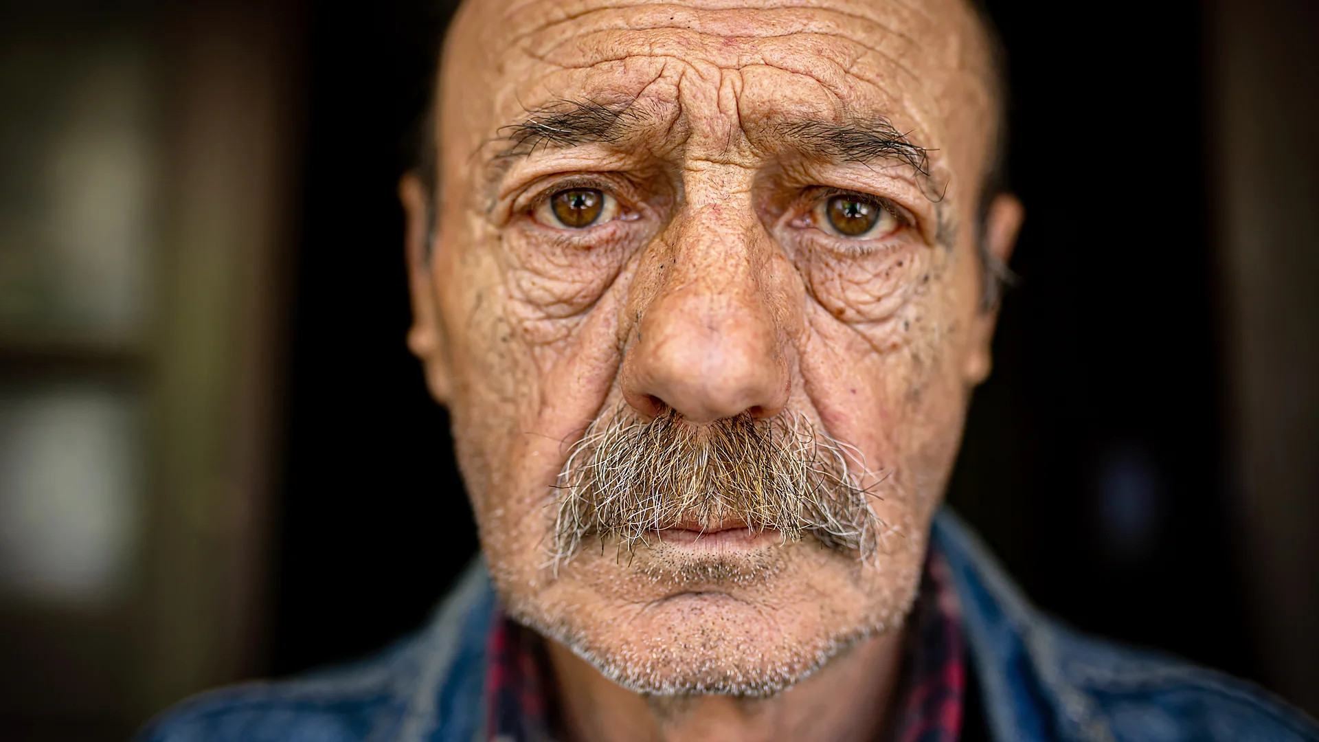 Sun-damaged skin linked to major age-related diseases, study finds