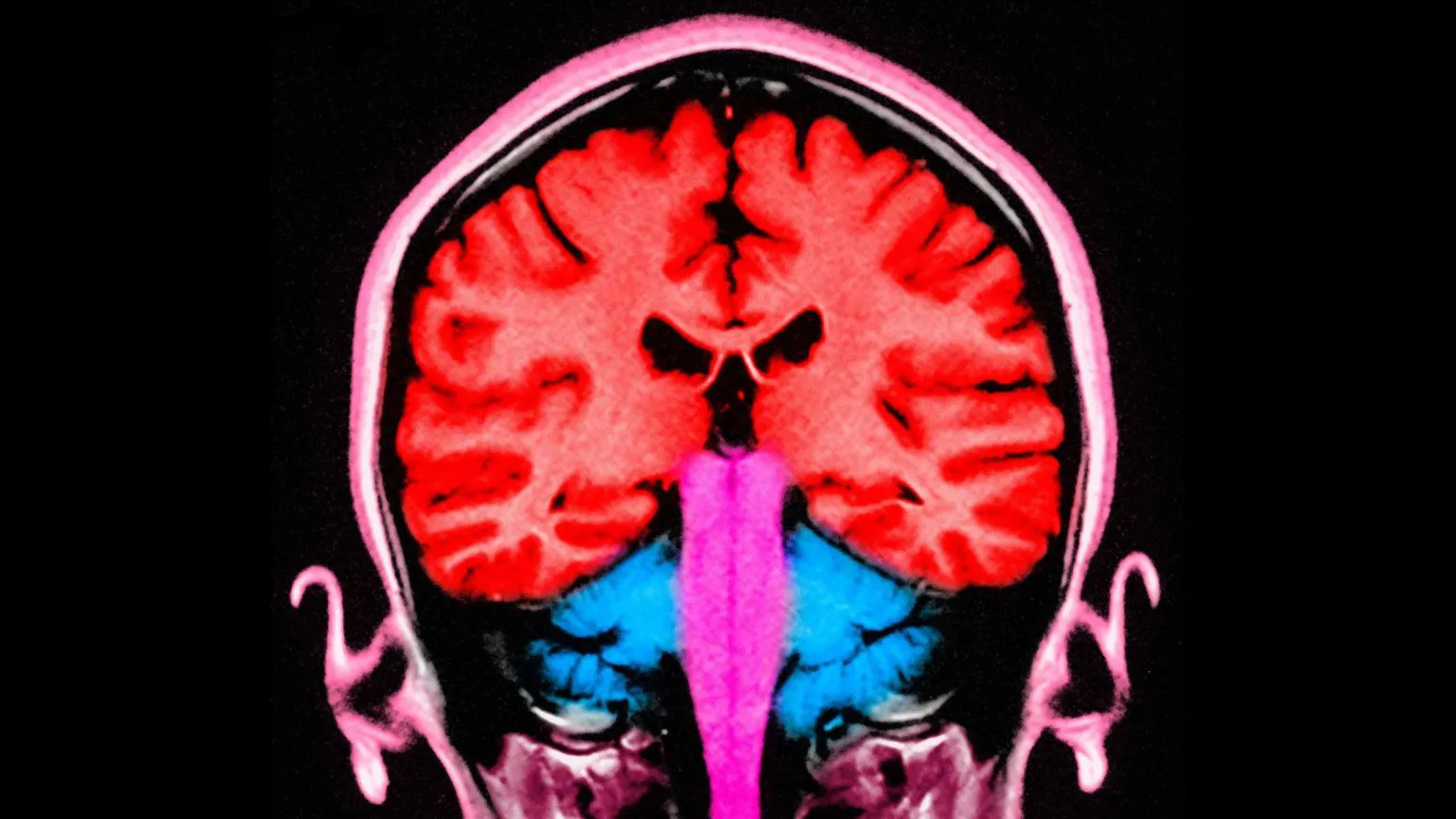 Brain stimulation temporarily boosts generosity in study