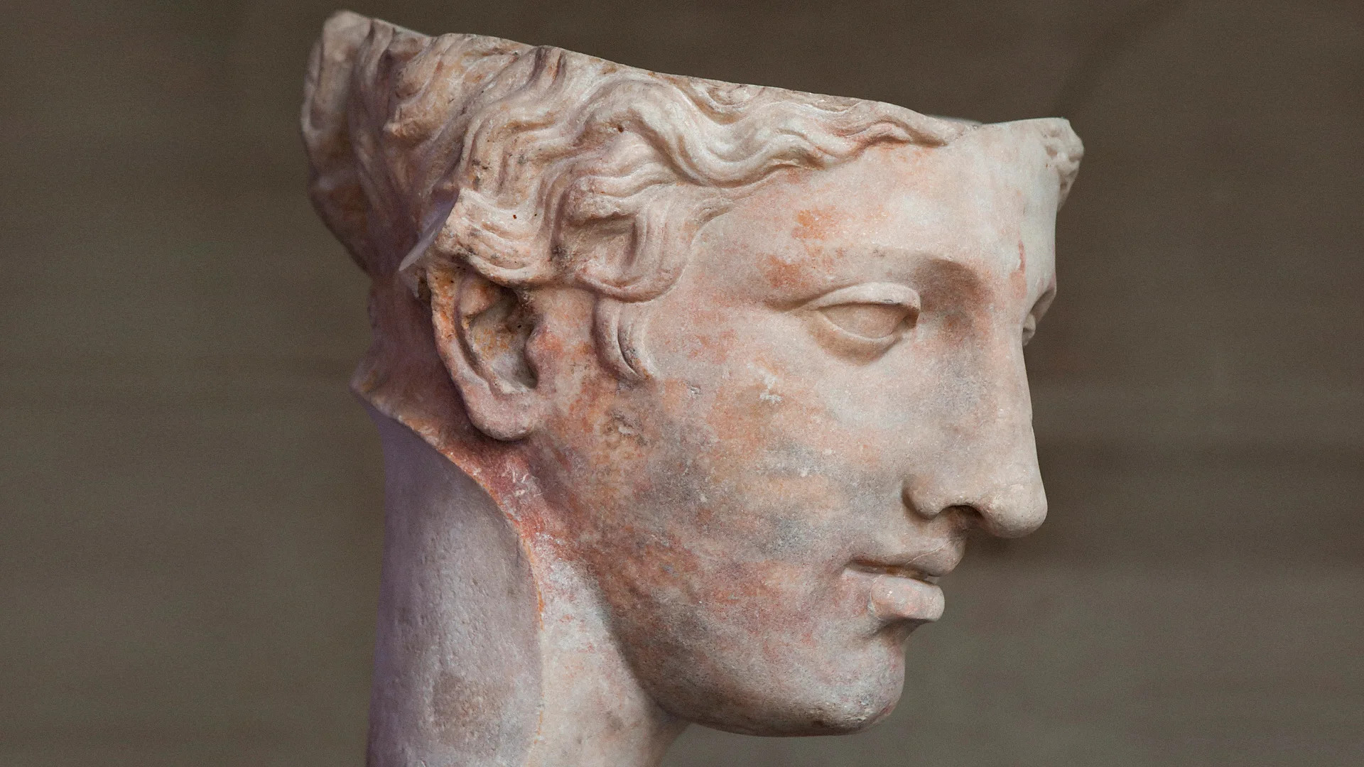 Migraines: The debilitating disorder dismissed as 'just a headache'