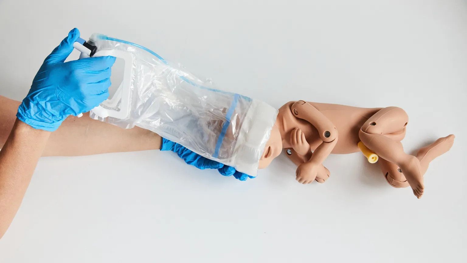 New birth device offers gentler alternative to forceps and ventouse