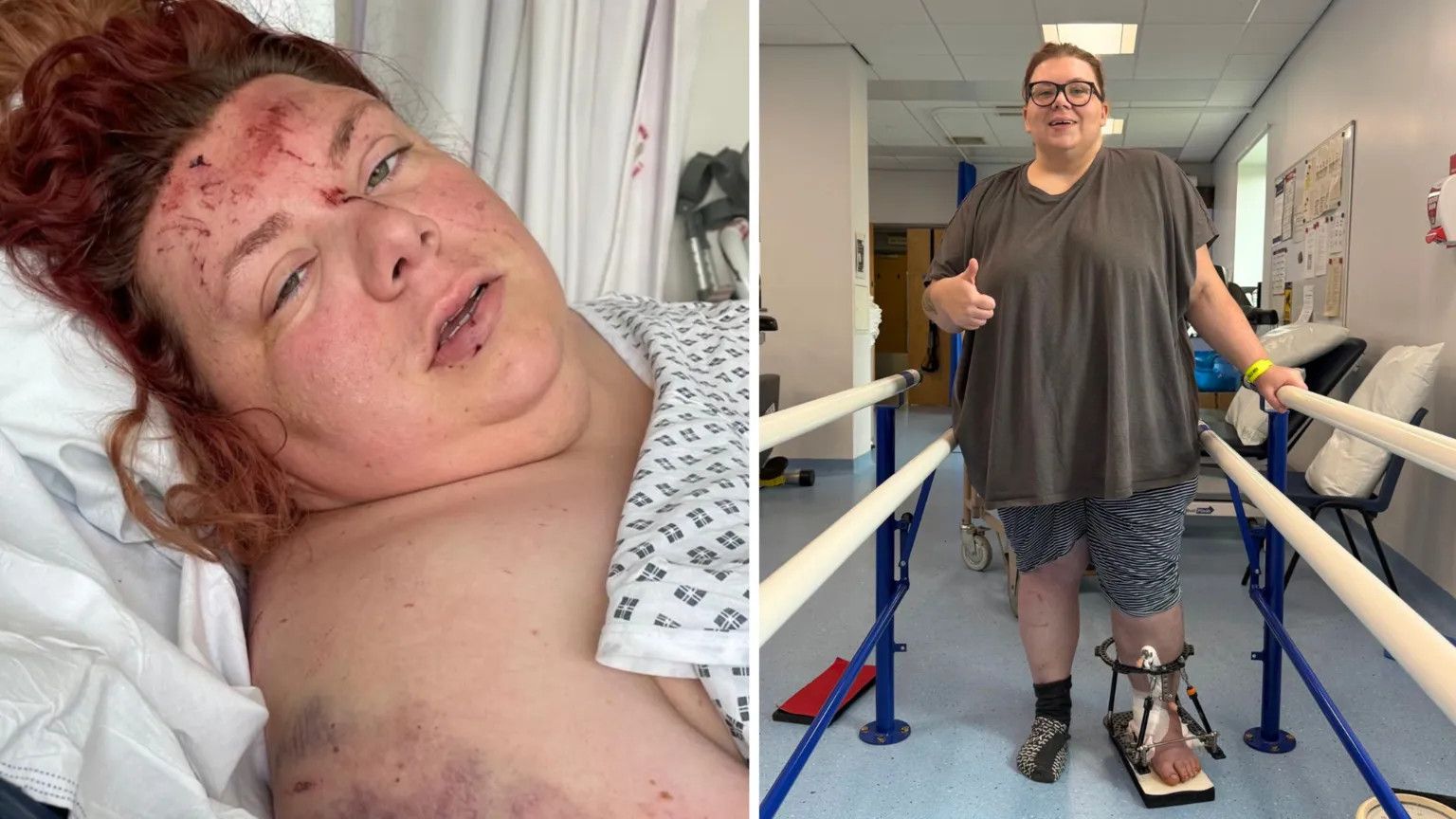Survivor credits iPhone crash detection after 100m mountain plunge